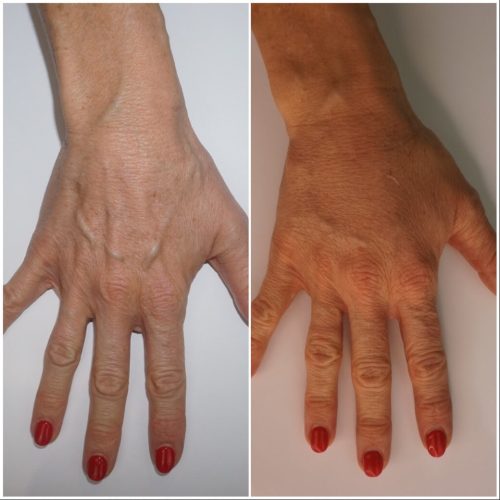 1EBF63C9-FCA3-478D-BF11-66473930FE26