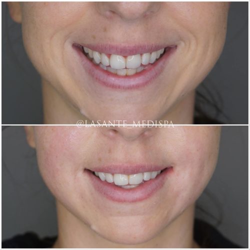 65F23B26-08B4-4E23-8F1F-E0F70216A43A