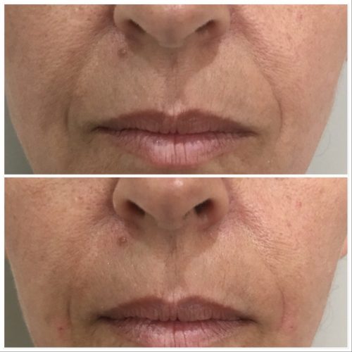 8368B5FB-BE04-4E8E-972B-938C576A51D1